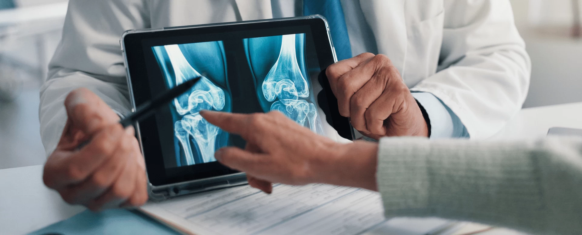 Sinais de falta de calcio nos ossos